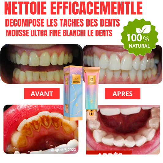 BIOCARE+™ – Dentifrice Soin Gencives & Éclat Blanchiment visible dès la 1ère semaine + Protection des gencives sensibles.