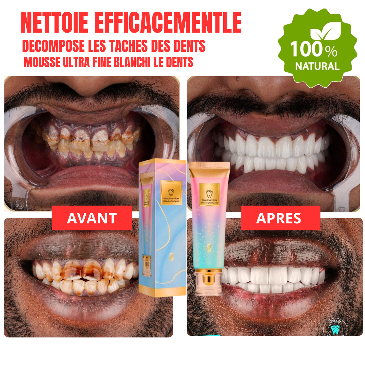 BIOCARE+™ – Dentifrice Soin Gencives & Éclat Blanchiment visible dès la 1ère semaine + Protection des gencives sensibles.