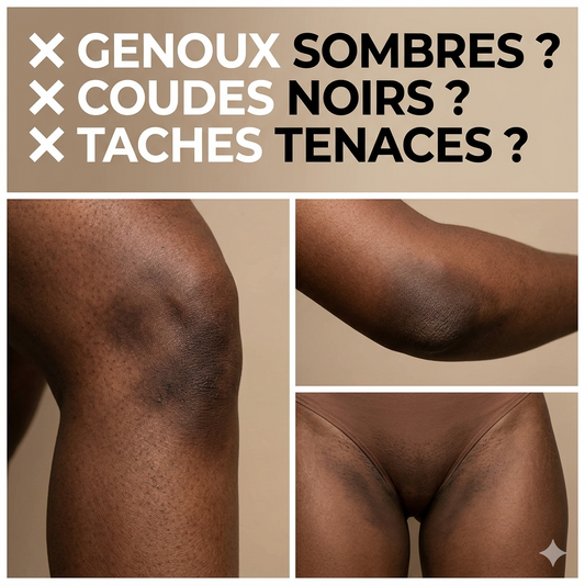 Vitamine c boost (Le tueur de zone rebelle)