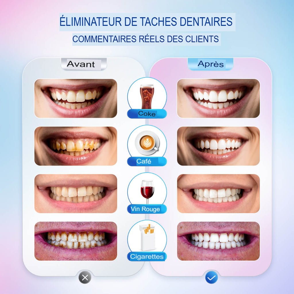 BIOCARE+™ – Dentifrice Soin Gencives & Éclat Blanchiment visible dès la 1ère semaine + Protection des gencives sensibles.