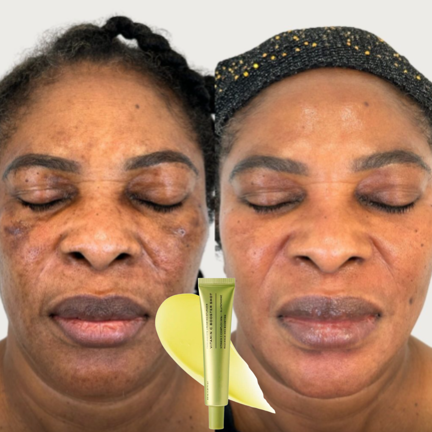 Vitamine c boost (Le tueur de zone rebelle)