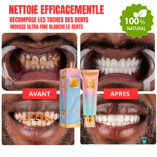 BIOCARE+™ – Dentifrice Soin Gencives & Éclat Blanchiment visible dès la 1ère semaine + Protection des gencives sensibles.