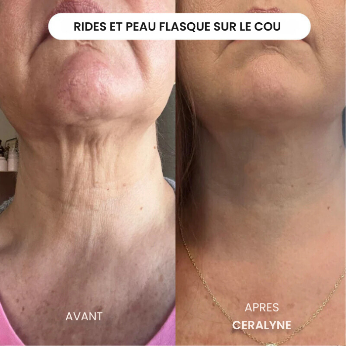 ✨ Éternelle Jeunesse — Le Masque au Collagène qui redonne vie à votre peau