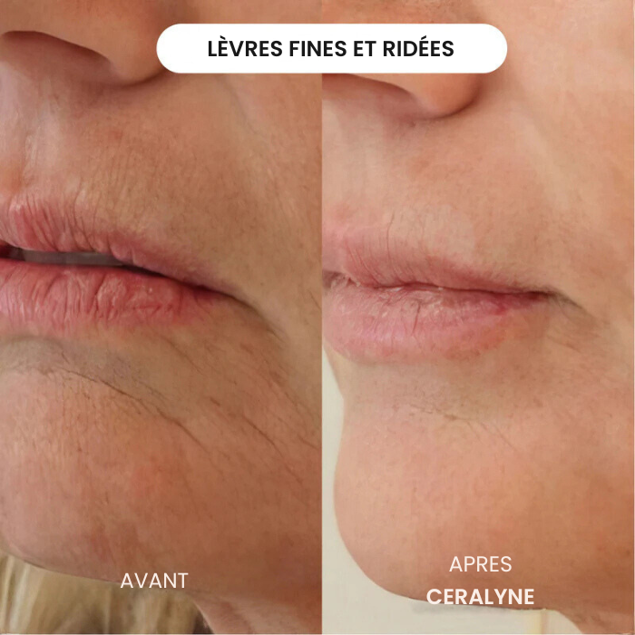 Éternelle™ Infusion Kit Rajeunir visiblement votre peau en agissant là où les crèmes classiques n'ont jamais pu pénétrer.