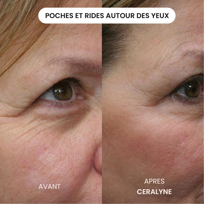 Éternelle™ Infusion Kit Rajeunir visiblement votre peau en agissant là où les crèmes classiques n'ont jamais pu pénétrer.
