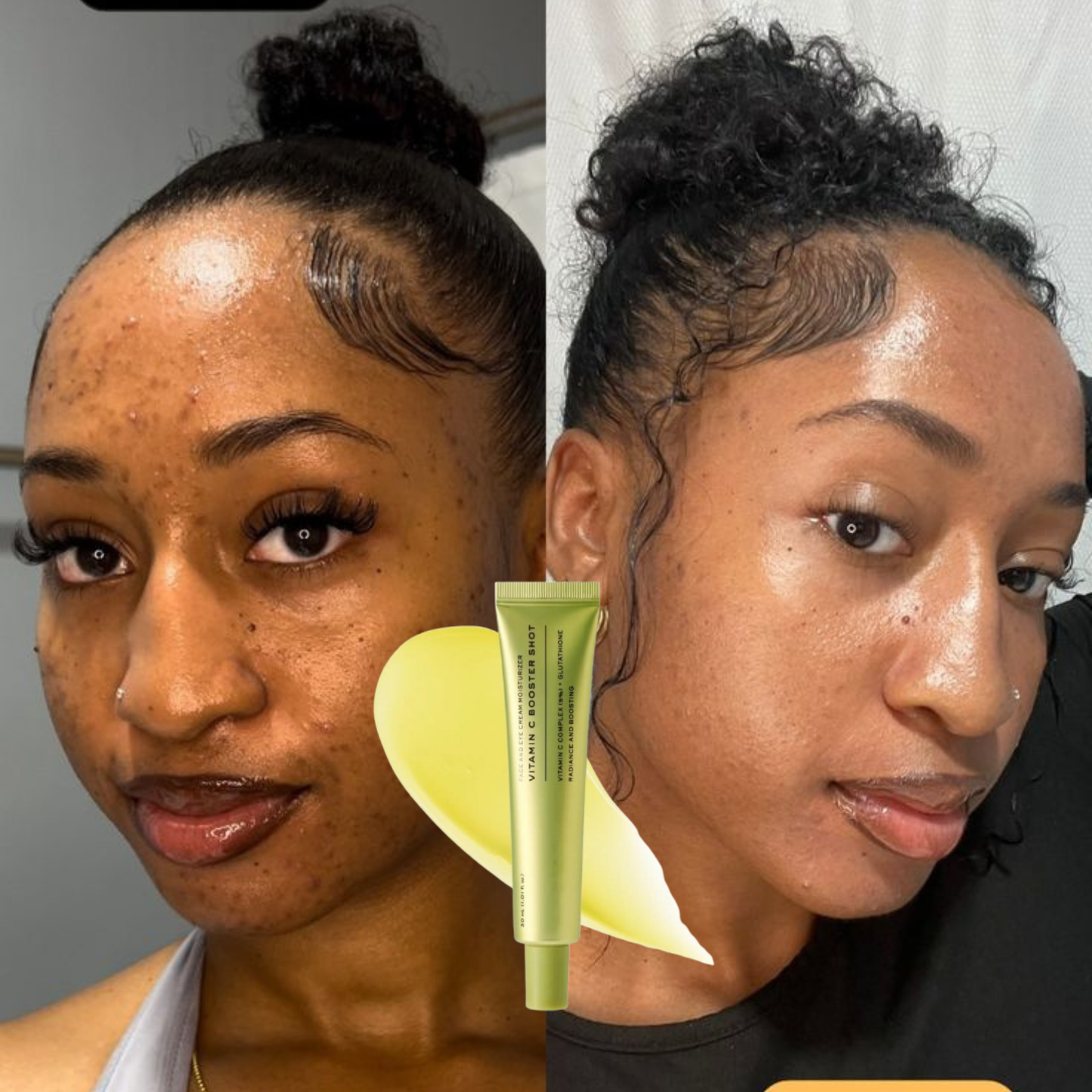 Vitamine c boost (Le tueur de zone rebelle)