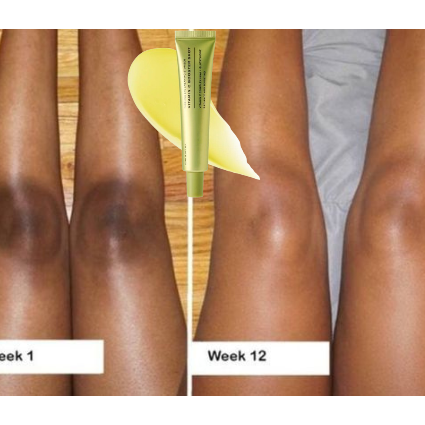 Vitamine c boost (Le tueur de zone rebelle)