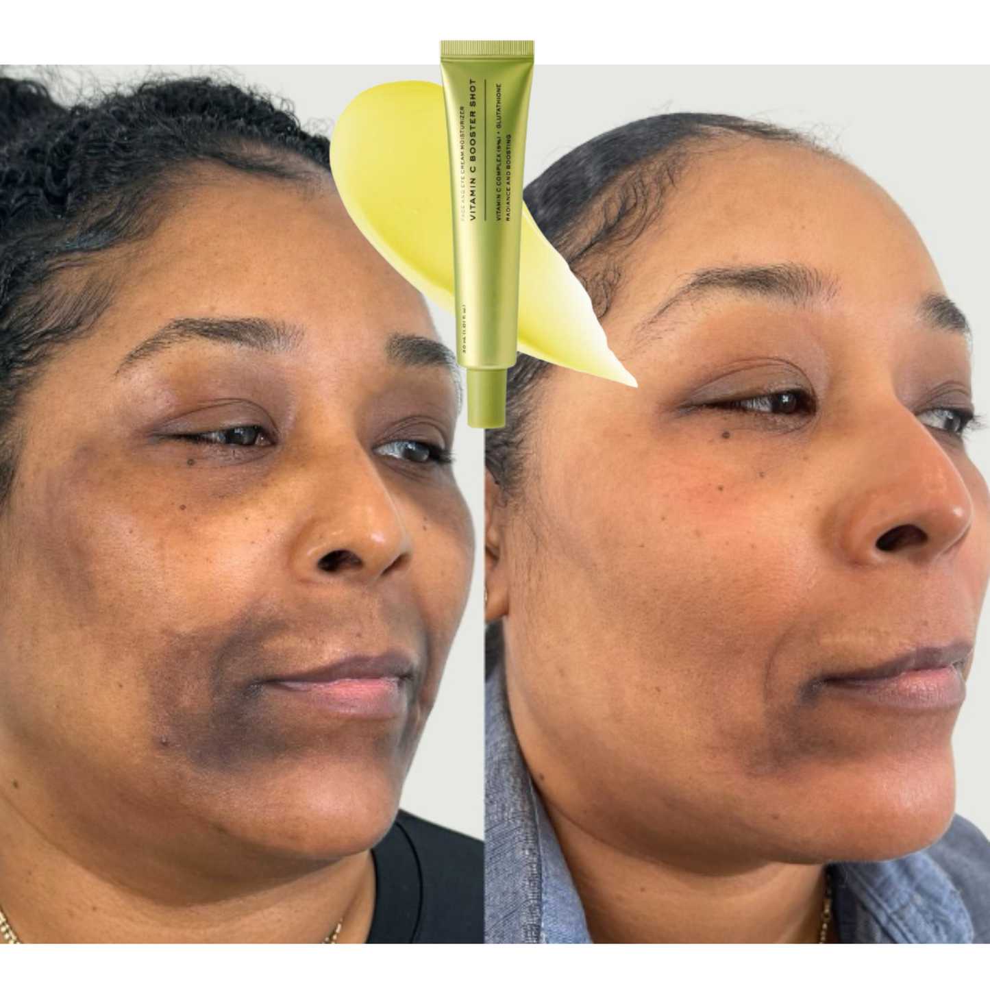 Vitamine c boost (Le tueur de zone rebelle)