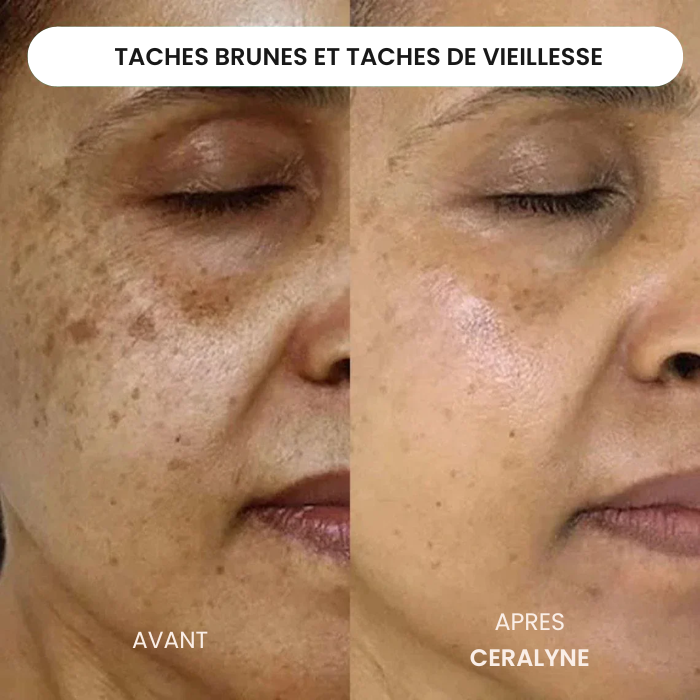 Éternelle™ Infusion Kit Rajeunir visiblement votre peau en agissant là où les crèmes classiques n'ont jamais pu pénétrer.