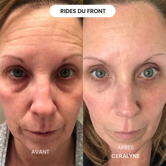 ✨ Éternelle Jeunesse — Le Masque au Collagène qui redonne vie à votre peau