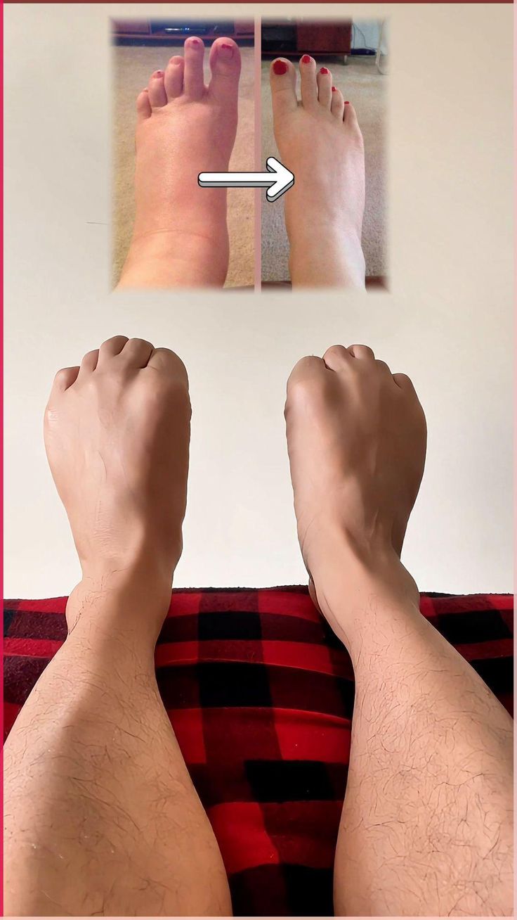 Retrouvez des pieds légers et détendus en 5 minutes par jour avec PiedZen™ — une solution simple, rapide et efficace contre les tensions plantaires.