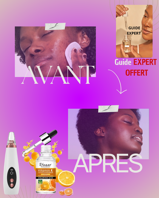 PACK PEAU LISSE: dite adieu aux imperfections sur le visage avec une solution pour une peau plus lisse et éclatante
