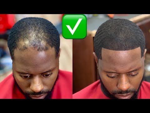 🌿 Huile de Batana 100% Pure – Redonne Vie à Vos Cheveux