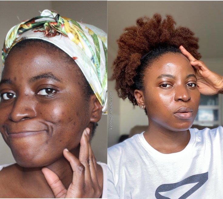 PACK PEAU LISSE: dite adieu aux imperfections sur le visage avec une solution pour une peau plus lisse et éclatante