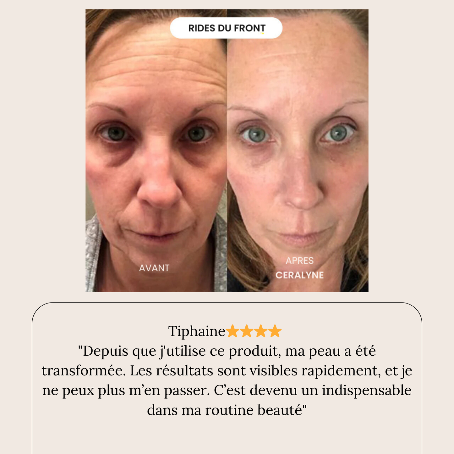 Éternelle™ Infusion Kit Rajeunir visiblement votre peau en agissant là où les crèmes classiques n'ont jamais pu pénétrer.