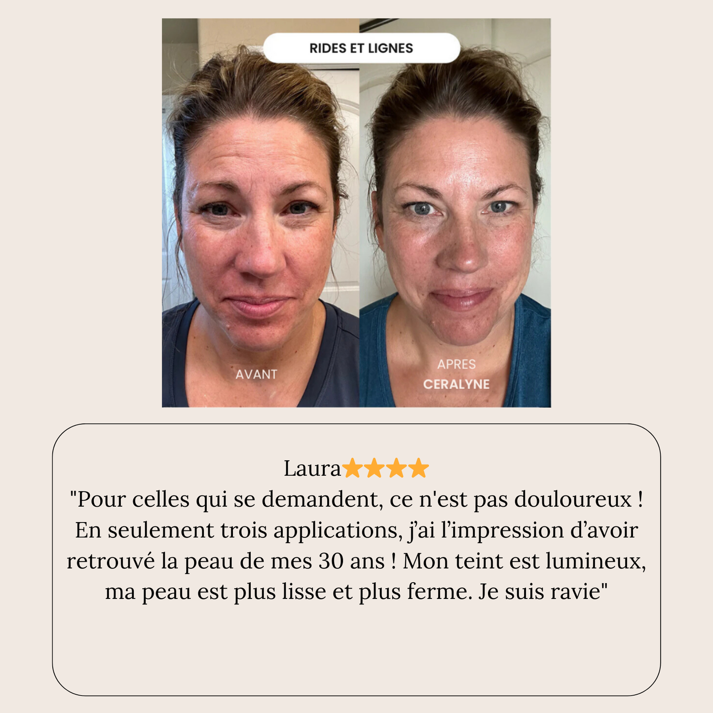 Éternelle™ Infusion Kit Rajeunir visiblement votre peau en agissant là où les crèmes classiques n'ont jamais pu pénétrer.