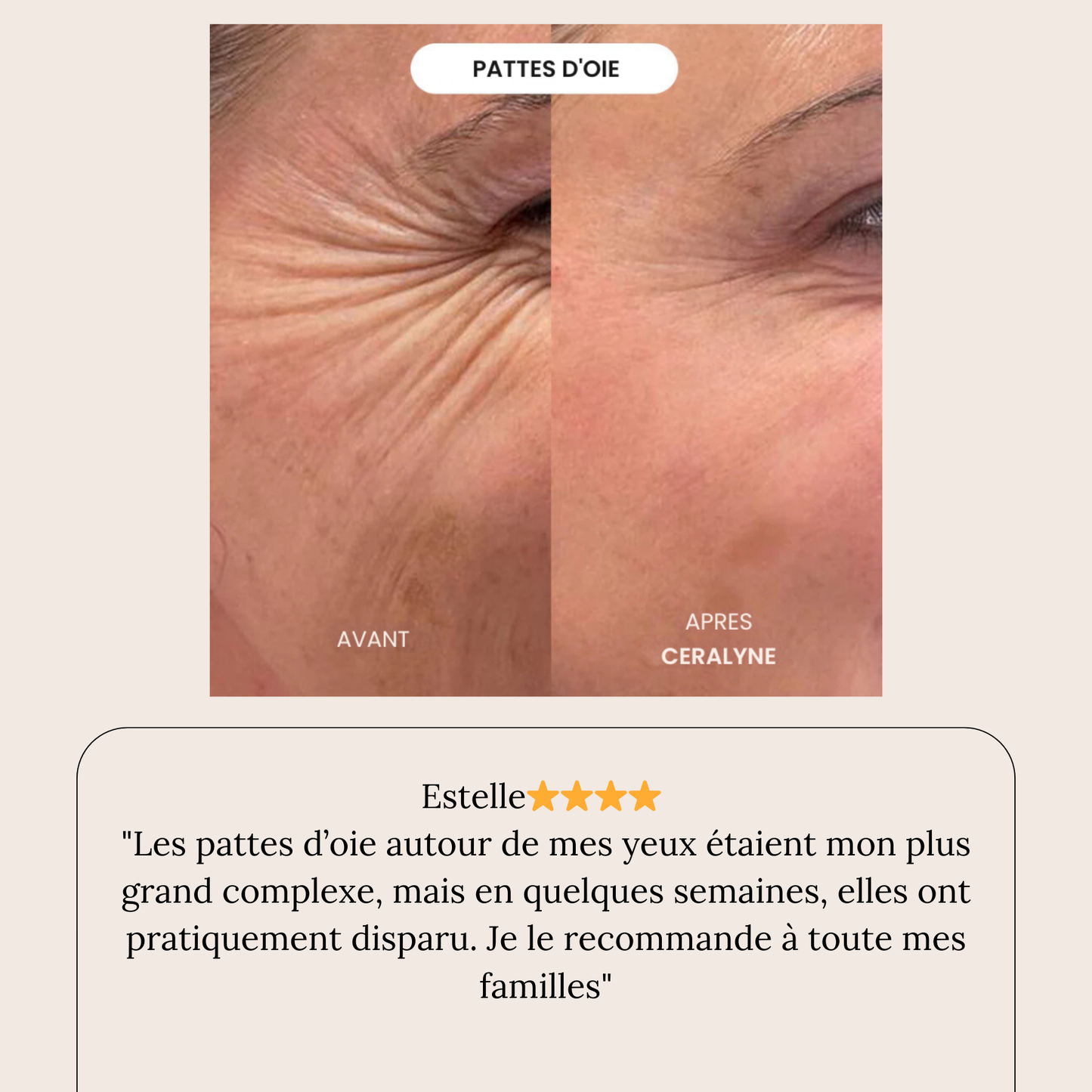 Éternelle™ Infusion Kit Rajeunir visiblement votre peau en agissant là où les crèmes classiques n'ont jamais pu pénétrer.