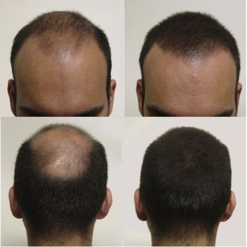 🌿 Huile de Batana 100% Pure – Redonne Vie à Vos Cheveux