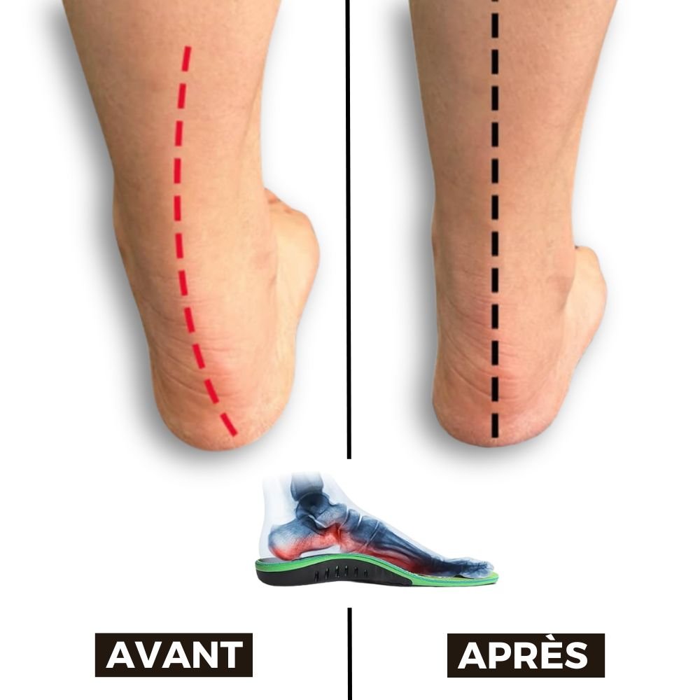 Semelles PiedZen™ - Acupression magnétique pour en finir avec les douleurs dus dos mauvaise posture et les douleur des jambes